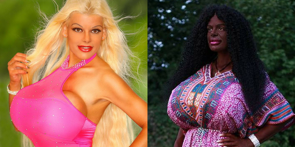 Transracial madness: White German woman Undertakes Surgeries to Become Black African 4 45o25pR