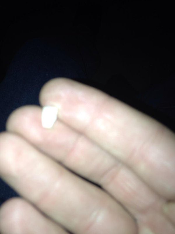 trump tooth