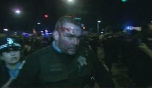 chicago cop bleeding 1