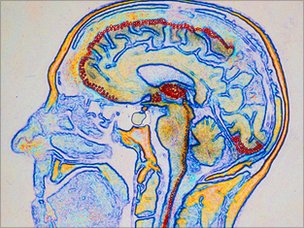 48455891 sensoryareasinhumanbrain,spl