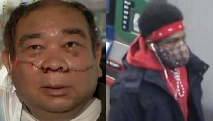 Noel Quintana with Attacker